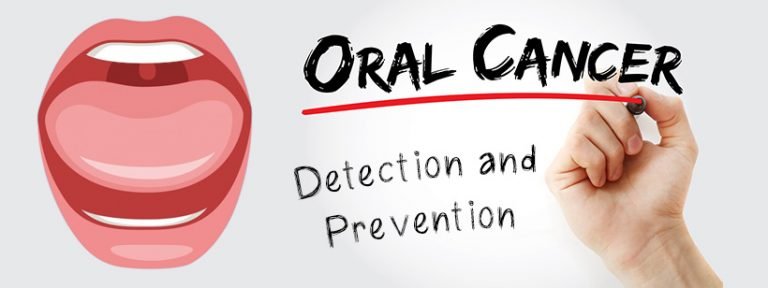 Oral Cancer - Detection and Prevention - Aperture Dental Practice