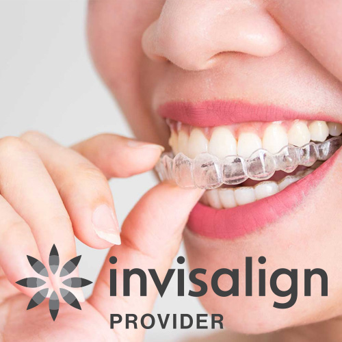 Invisalign Clear Aligners in Sunnybank Hills - Aperture Dental Practice
